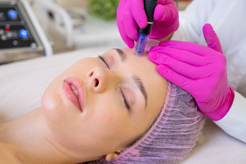 Medical Asthetics - Microneedling